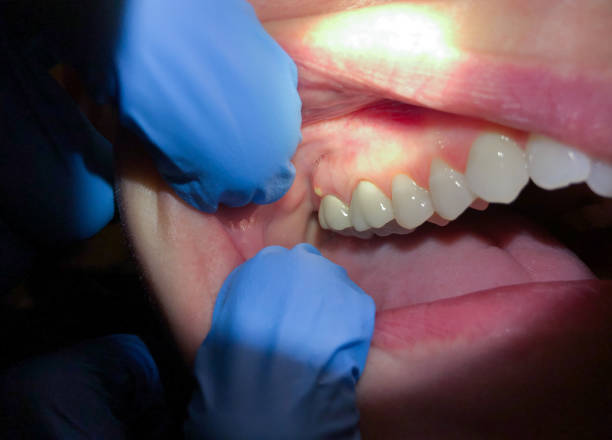Best Emergency Dental Care for Trauma or Injury in Vineyard Haven, MA